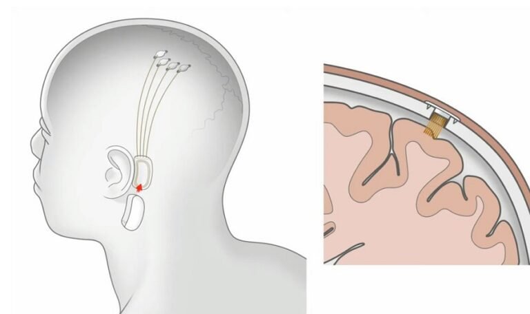 cerveau humain et circuits electroniques entremeles